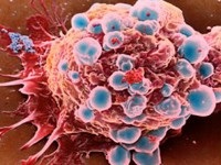 Раковые клетки